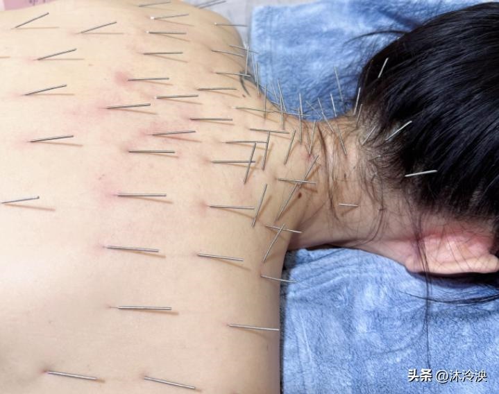 图片[3]-从头到脚近百针！46岁陈乔恩针雕美容后首次现身，幼态脸太显年轻-创优资源分享网