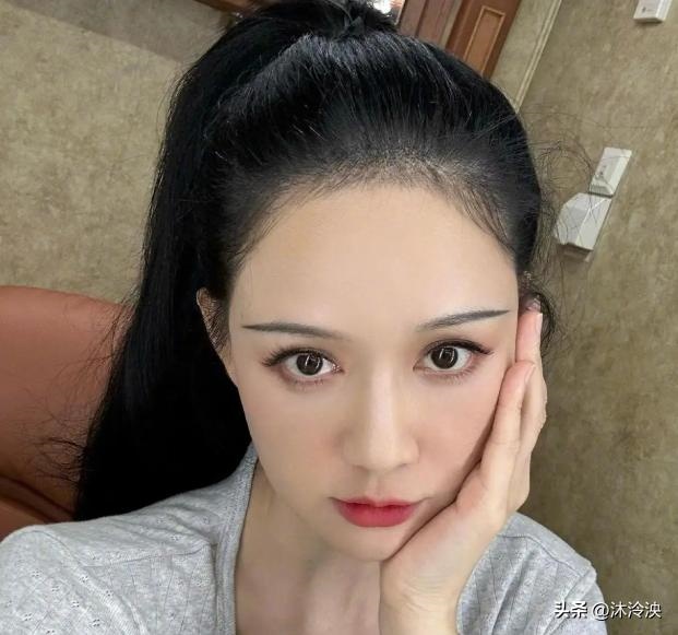 图片[1]-从头到脚近百针！46岁陈乔恩针雕美容后首次现身，幼态脸太显年轻-创优资源分享网