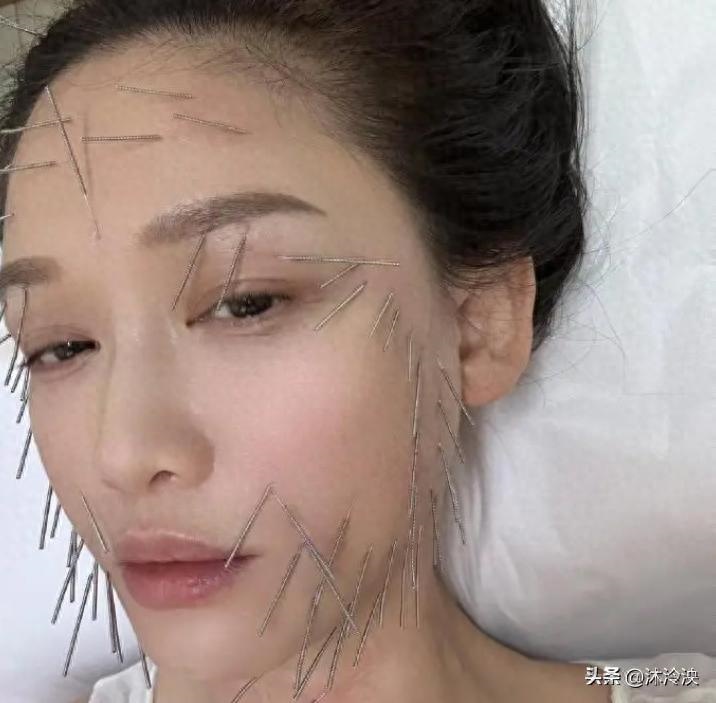 图片[4]-从头到脚近百针！46岁陈乔恩针雕美容后首次现身，幼态脸太显年轻-创优资源分享网