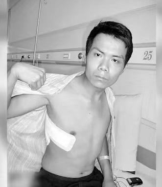 张海超在经历了16年的开胸验肺手术后，提及往事时不禁泪流满面，然而，积极面对生活并好好活着，依旧是他不可推卸的责任。-柠檬资源分享网