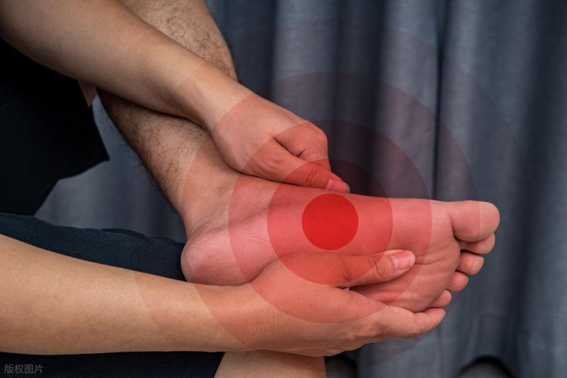 图片[2]-花生对于高尿酸患者来说，一口都不宜品尝？专家警示：若不想长期卧床，以下五种食物需适量减少摄入-创优资源分享网