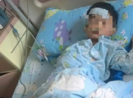 一名6岁的儿童不慎赤脚踩到一条死鱼，结果情况严重，被紧急送往重症监护室（ICU）治疗。-创优资源分享网