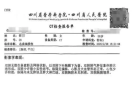 某医院误将患者CT影像资料弄混，导致一位女性患者被错误诊断为患有“绝症”，并连续服用药物三个月。-创优资源分享网