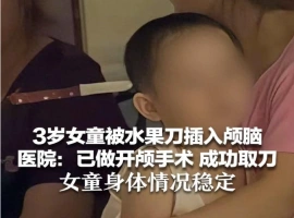 三岁女童头部被水果刀刺伤，紧急开颅取出刀具，现无生命危险，状况稳定。-创优资源分享网