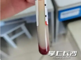 宵夜后29岁男子血液呈现乳白色-创优资源分享网