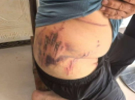 湖北某村民遭遇野兽袭击，身体受伤，目前尚在调查该野兽是否为华南虎或其他种类。-创优资源分享网