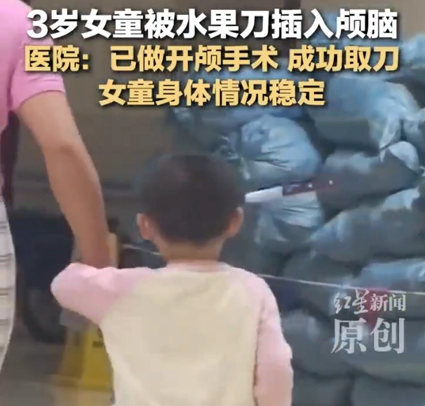 图片[2]-三岁女童头部被水果刀刺伤，紧急开颅取出刀具，现无生命危险，状况稳定。-创优资源分享网