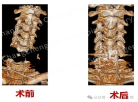 我国医疗队伍成功救治一例罕见“头身分离”病例-创优资源分享网