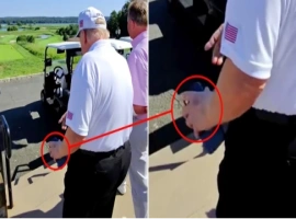 美国媒体报道：特朗普总统左手显现不明淤青，白宫作出回应-创优资源分享网