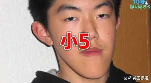 图片[5]-日本男子因“世界最长下巴”而名声大噪：从自卑走向网络红人的蜕变-创优资源分享网